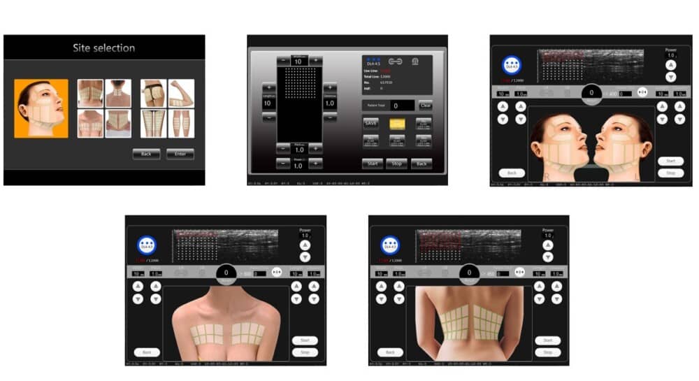 a screenshot of a medical device